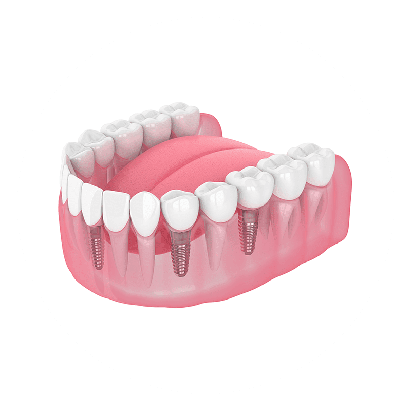 multiple-missing-teeth-160x160-1