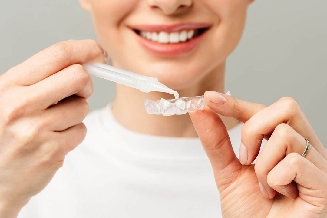 Teeth Whitening treatment Woking